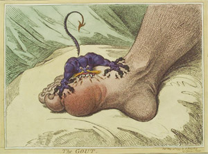 Gout