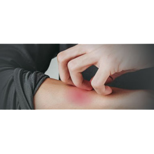 Scratch that Itch!